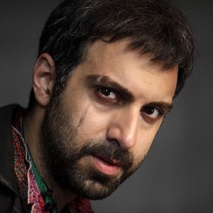 پولاد کیمیایی سر صحنه فیلمبرداری «متروپل» دچار سانحه شد
